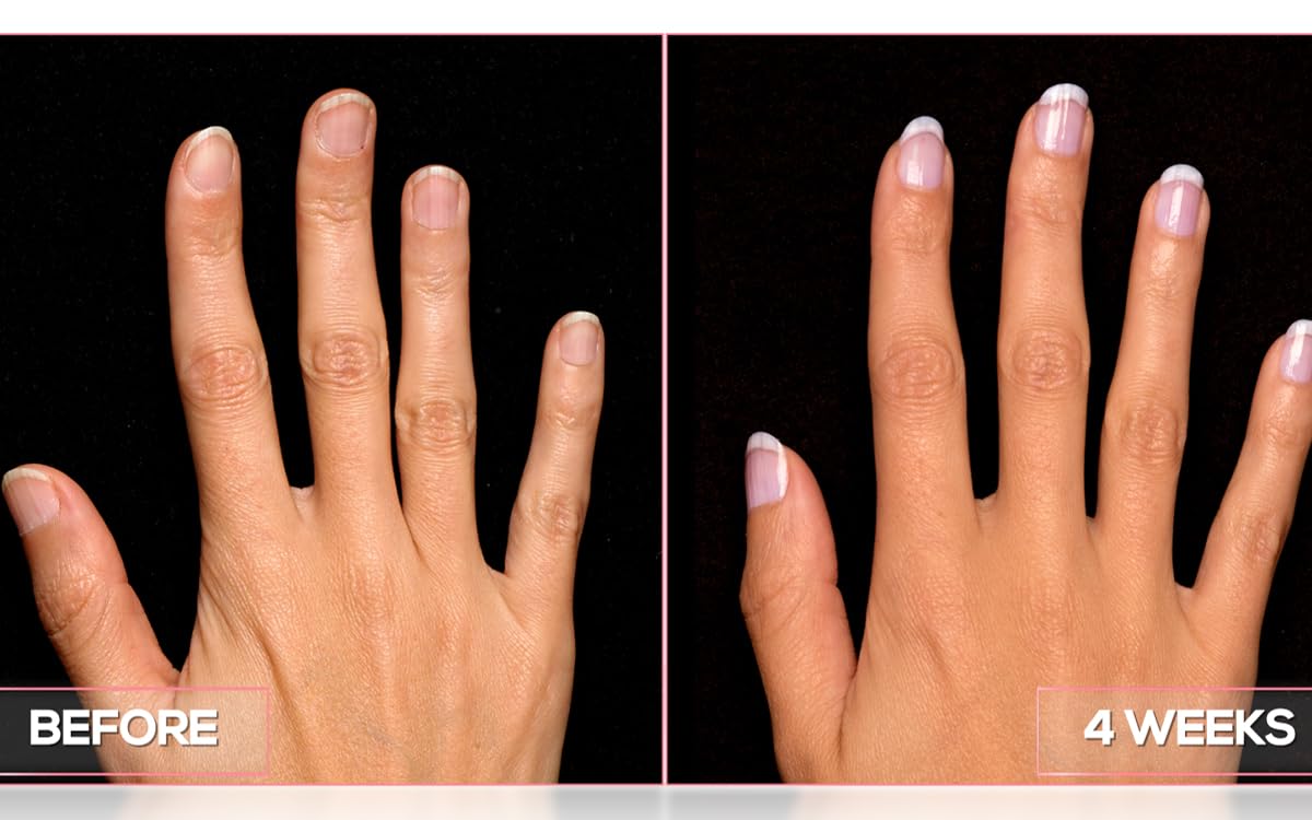 Perfect Formula Manicure Booster - Base and Top Coat Nail Strengthener, Keratin Treatment - Strengthener for Damaged Nails - Made In The USA .60 fl oz.