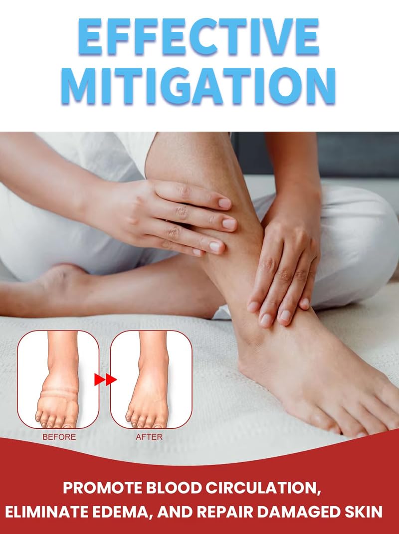 Leg Slimming Massage Cream | Soothing Swelling, Tightening Skin, Auxiliary Care for Reducing Edema （2 Pieces） bobojujuBuy Supplements Australia