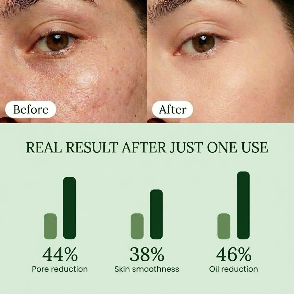 QUIA Toner Pads – AHA/BHA Dual-Action Exfoliate and Hydrate All in One – Soothing Formula for Sensitive Skin – Reduces Blackheads and Blemishes