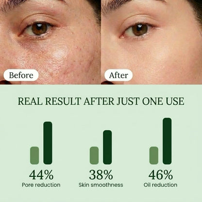 QUIA Toner Pads – AHA/BHA Dual-Action Exfoliate and Hydrate All in One – Soothing Formula for Sensitive Skin – Reduces Blackheads and Blemishes