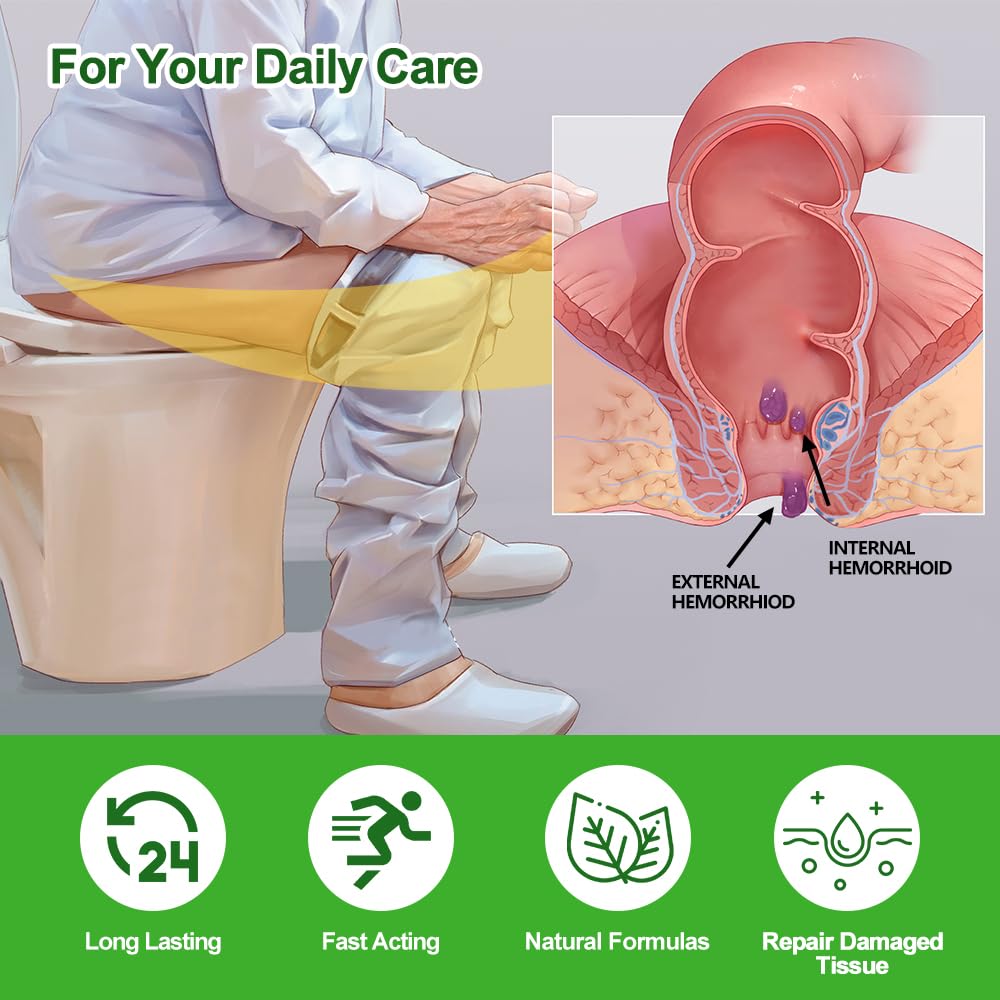 RHAICARE Hemorrhoid and Fissure Cream,Hemorrhoidal Ointment for Fast Acting Itch, Swelling, and Maximum Strength Pain Relief（1 Pack RHAICAREBuy Supplements Australia