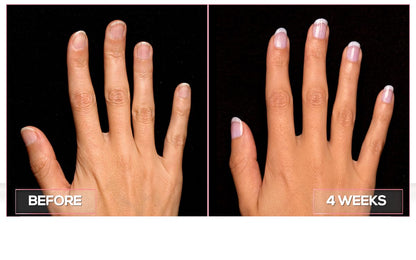 Perfect Formula Manicure Booster - Base and Top Coat Nail Strengthener, Keratin Treatment - Strengthener for Damaged Nails - Made In The USA .60 fl oz.