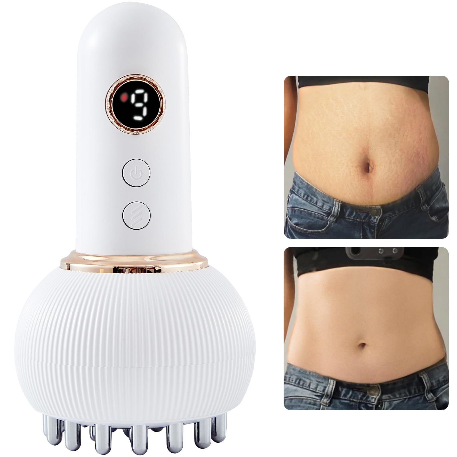 FEEOLA Lymphatic Drainage Massager & Cellulite Massage Tool, Helps Reduce Stretch Marks & Cellulite, for Legs, Arms & Belly, Body Sculpting Machine with Microcurrent, Light, Heat & Vibration FEEOLA buy supplements Au