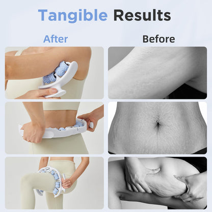 OVGIAP Cellulite Manual Massager for Legs & Thighs - Lymphatic Drainage Tool, Handheld Fascia Blaster for Deep Tissue, Body Sculpting Cellulite Remover(Blue) OVGIAP buy supplements Au