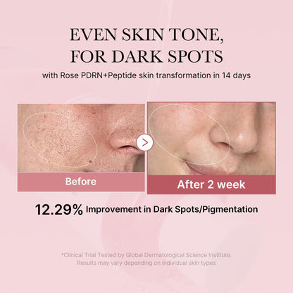 medicube PDRN Toner Rose PDRN Peptide Toner | Lightweight & Watery Type for Skin Boosting, Soothing and Calming, Uneven Skin Tone | with Rose, Peptide, Niacinamide | Korean Skincare, 8.45 fl.oz medicubeBuy Supplements Australia