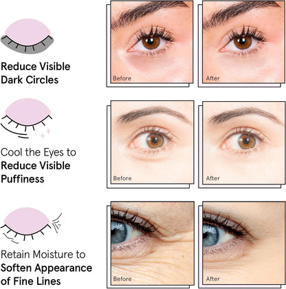grace & stella Award Winning Under Eye Mask - Birthday Gifts for Women - Gel Eye Patches