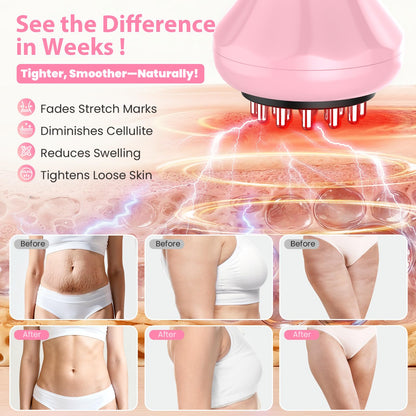 Lymphatic Drainage Massager, Anti Cellulite Massage Tool For Thigh & Belly Stretch Marks & Cellulite Reduction, Handheld Massage tools for Sciatica Nerve, Legs, Arms, Hip, Muscle, Low Back Pain Relief AIHEU buy supplements Au
