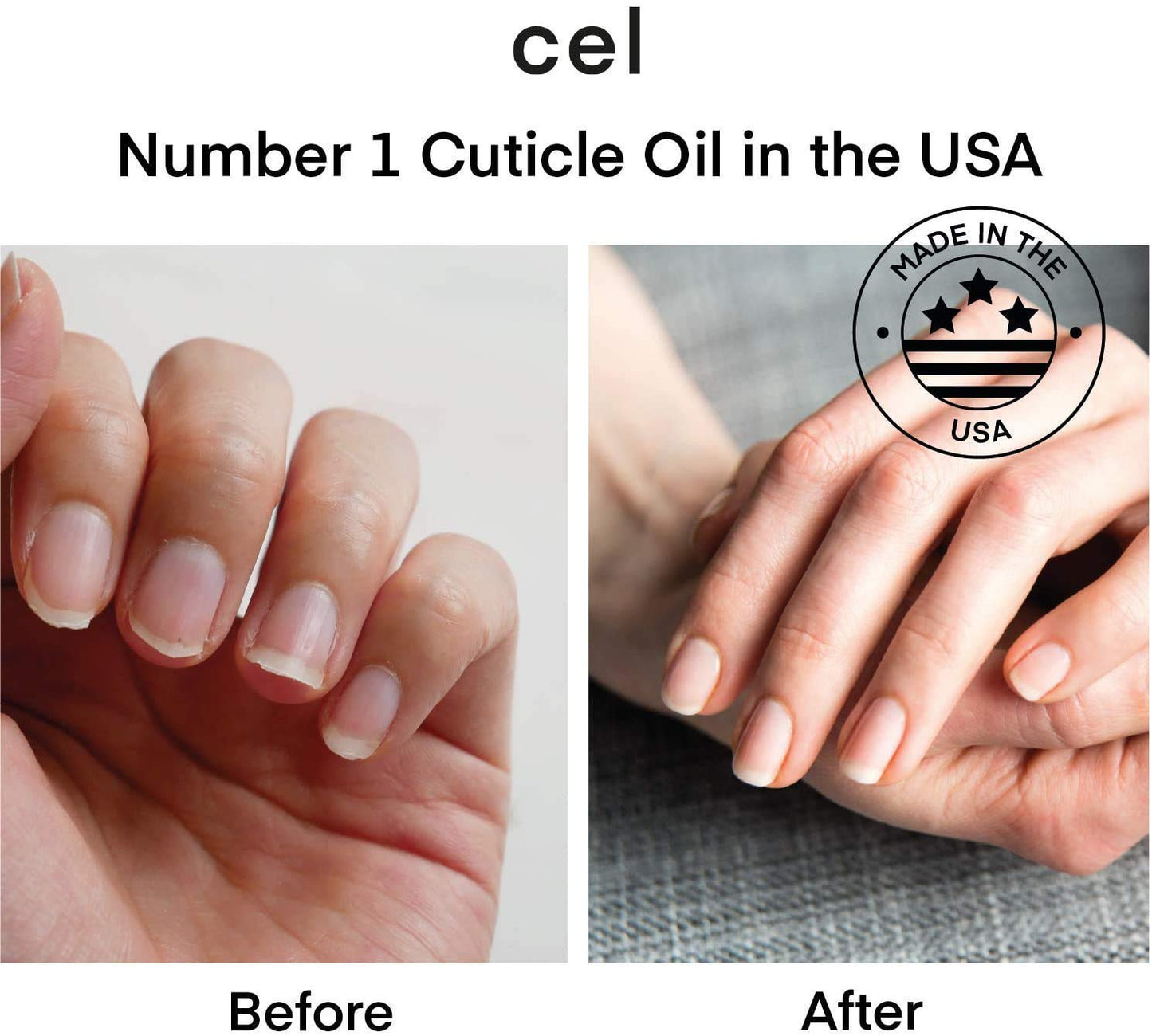 cel MD Cuticle Oil Pen Nail Strengthener Repair Serum – Nail Repair For Damaged Nails – Helps Repair & Nourish Cracked Nails