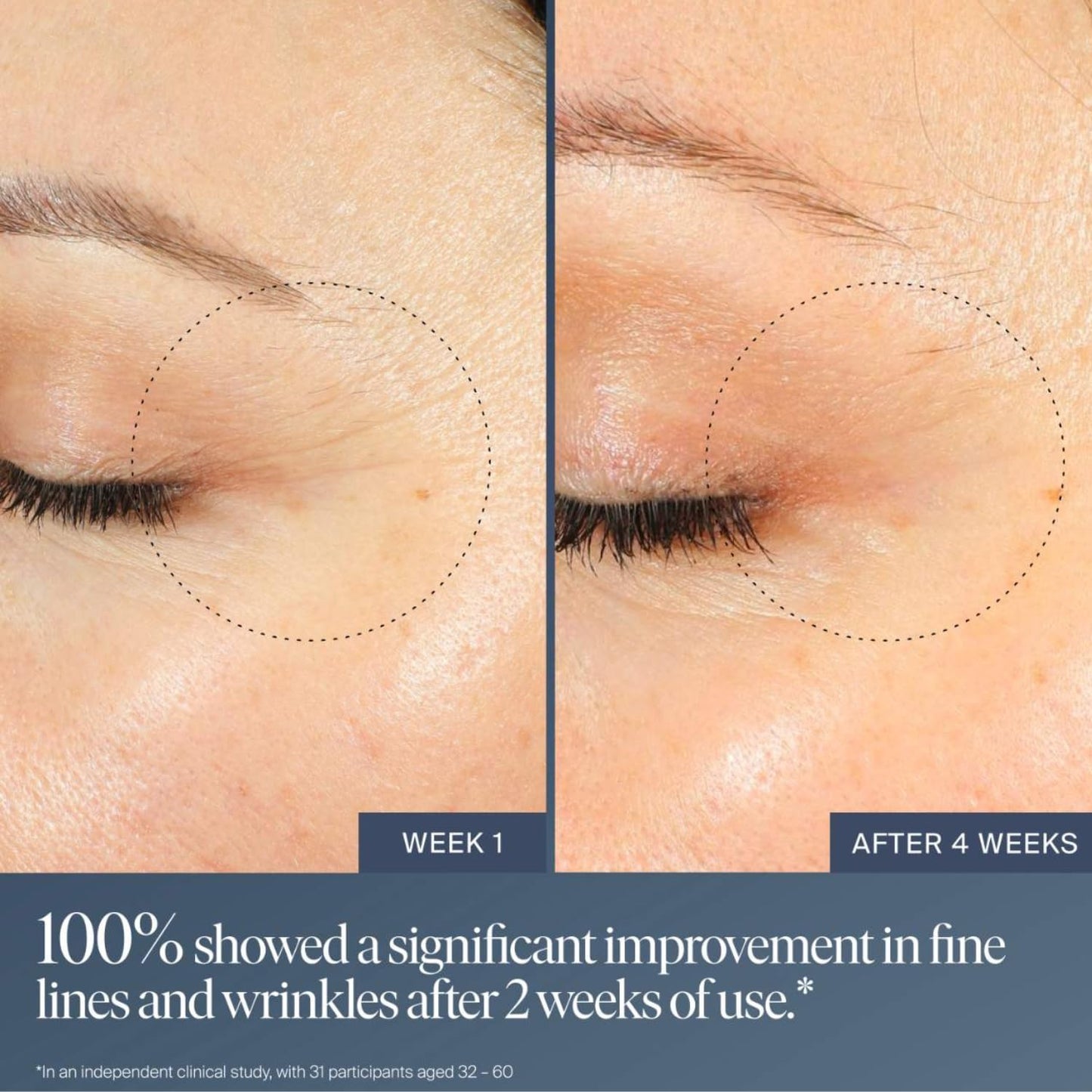 Summer Fridays Jet Lag Overnight Eye Serum - Nourishing Undereye Treatment for Dark Circles - Helps to Hydrate, Smooth, Firm & Depuff - Enriched with Glycerin to Lock in Moisture (0.5 Fl Oz) Summer FridaysBuy Supplements Australia