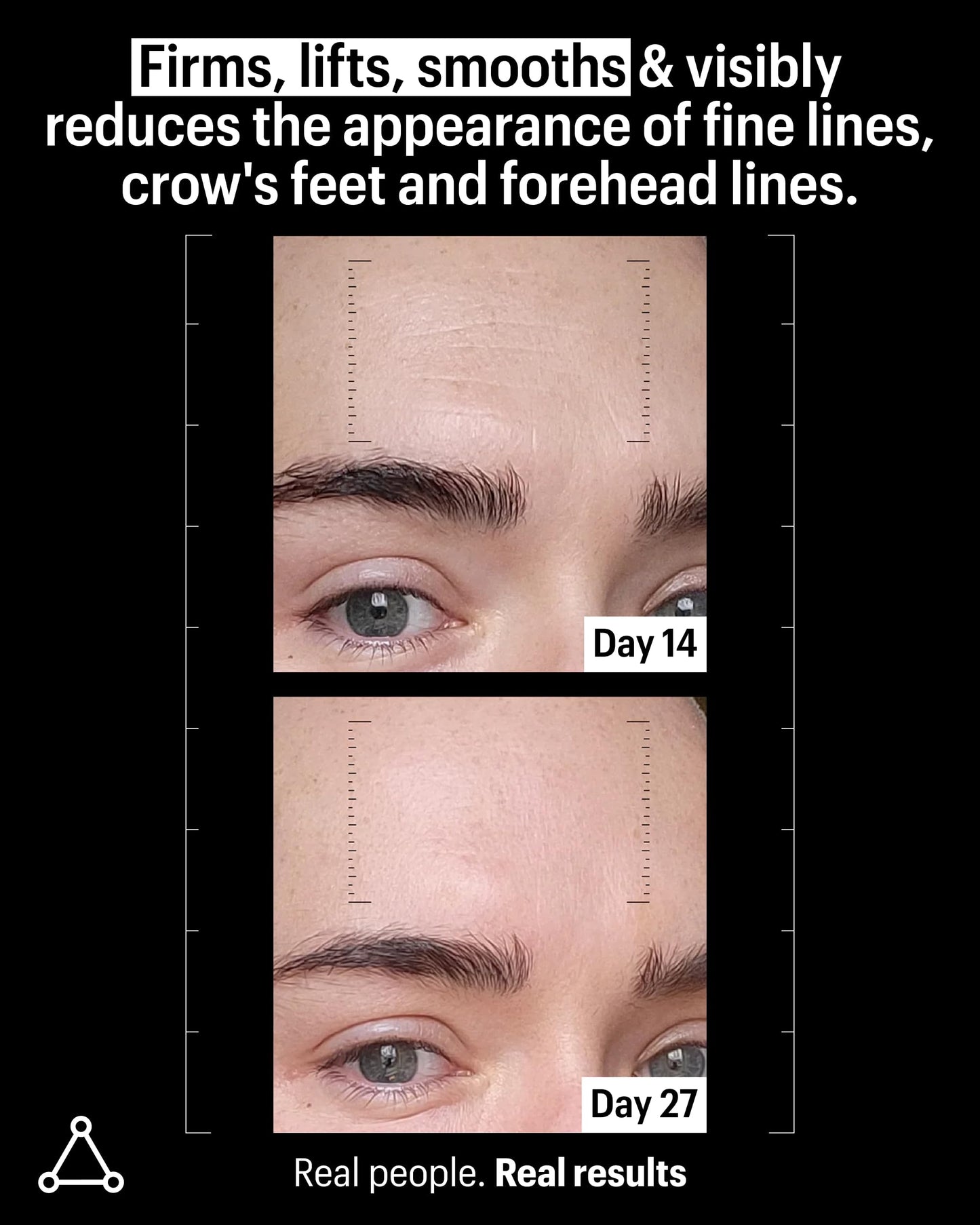 Allies of Skin Multi Peptides & Growth Factor Collagen Boosting Face Serum | Skin Tightening Anti-Aging Complex with 9% Peptides| Firms Sagging Skin & Visibly Reduces Wrinkles (1 oz) Allies of SkinBuy Supplements Australia