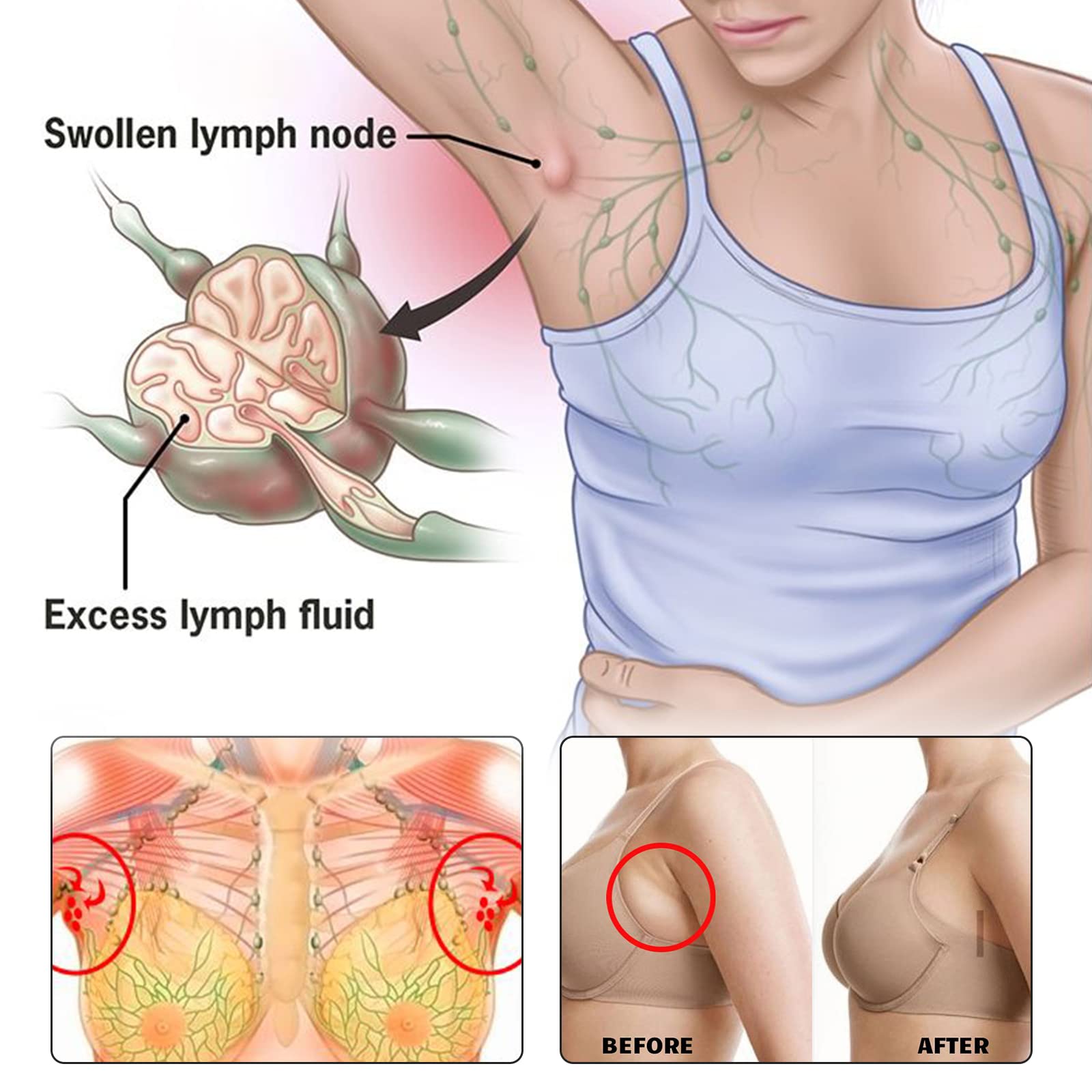 BXQJRJLymphatic Drainage Patch Lymphatic Drainage Herbal Lymphatic Drainage Care Patch Herbal Neck Patch (12) BXQJRJ buy supplements Au