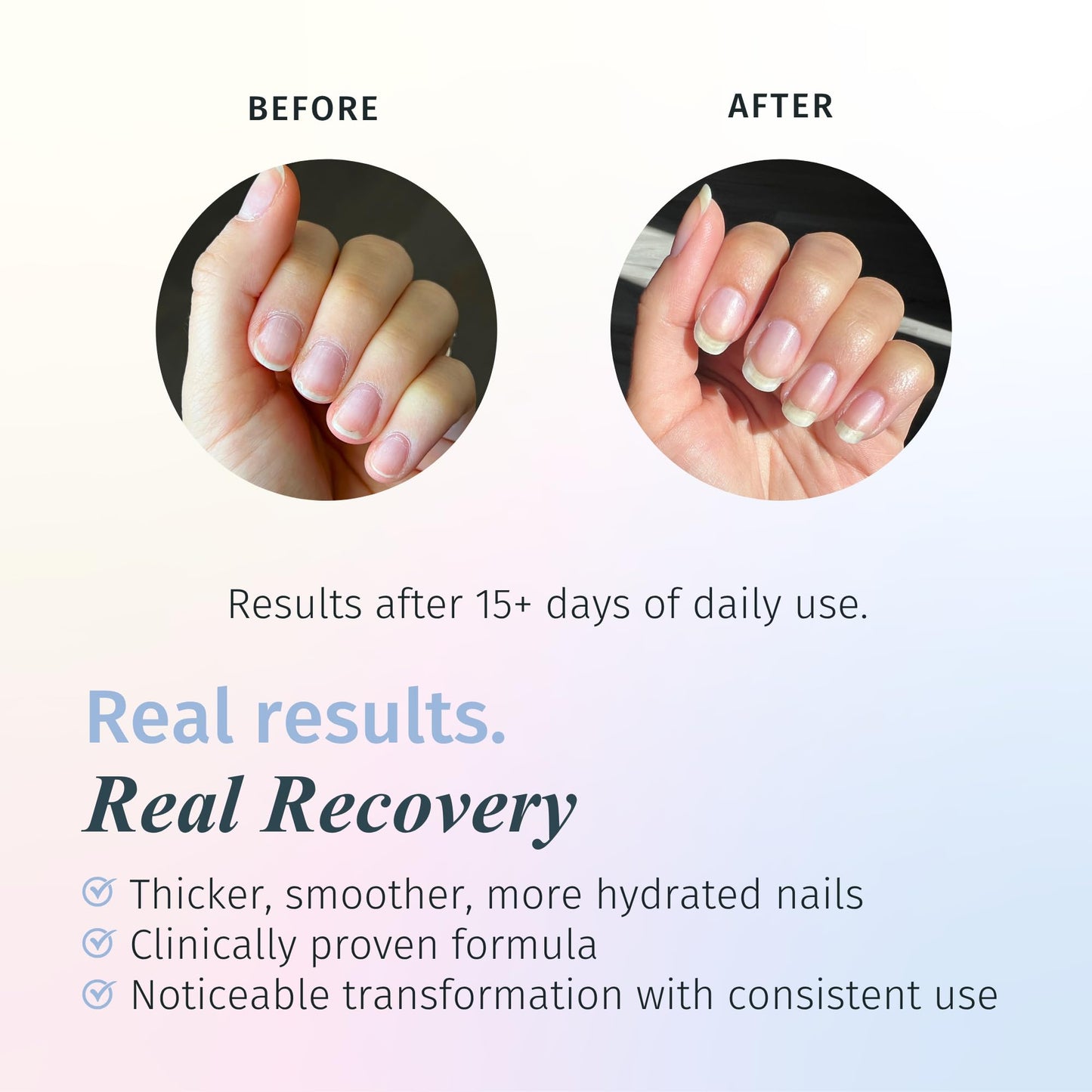 Duri Rejuvacote 1 Original Maximum Strength Nail Growth System Base and Top Coat - Nail Hardener Repair Chipping Strengthen Breaking