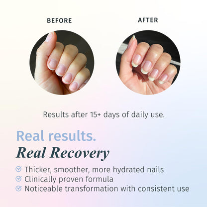 Duri Rejuvacote 1 Original Maximum Strength Nail Growth System Base and Top Coat - Nail Hardener Repair Chipping Strengthen Breaking