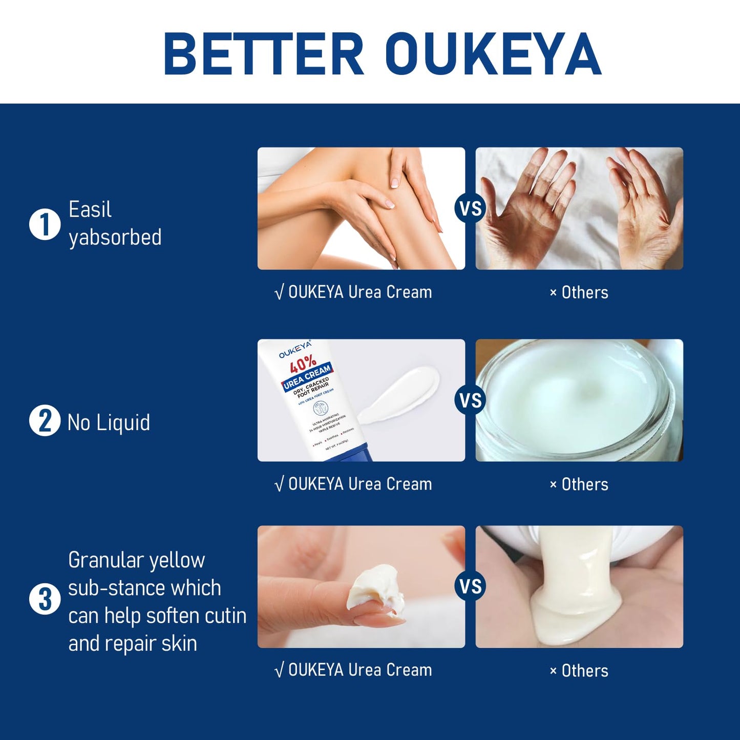 OUKEYA Urea Cream 40 Percent Tube 3 Oz, Foot & Hand Cream for Dry Cracked, 40 per Urea Lotion for Feet Maximum Strength