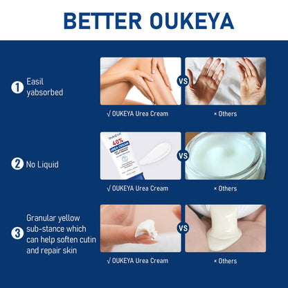 OUKEYA Urea Cream 40 Percent Tube 3 Oz, Foot & Hand Cream for Dry Cracked, 40 per Urea Lotion for Feet Maximum Strength