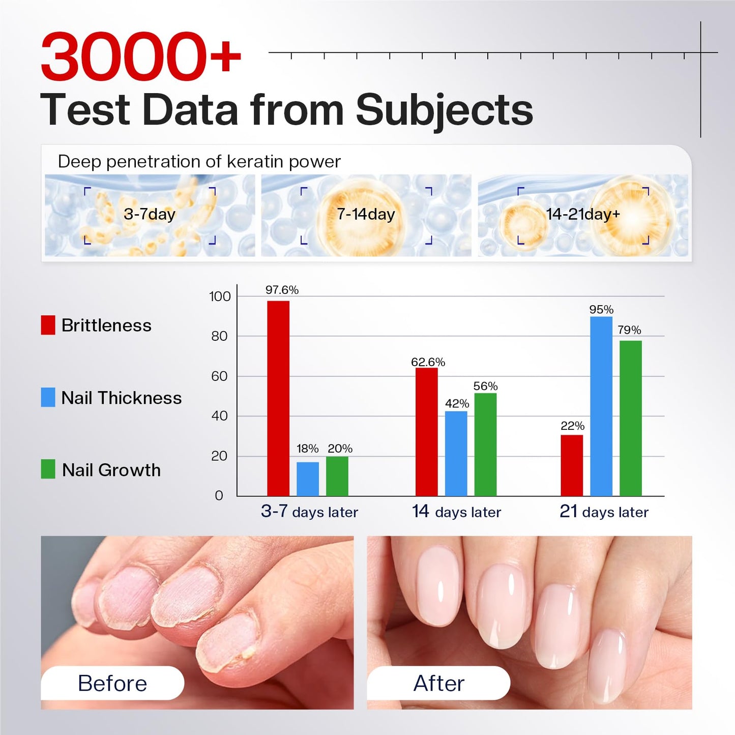 Morovan Nail Strengthener And Hardener: Milky White Ridge Filler Nail Concealer With Keratin For Thin Weak Brittle Nails, Strengthening Polish Repair For Damaged Nails, Air Dry Natural Nail Care 15ml