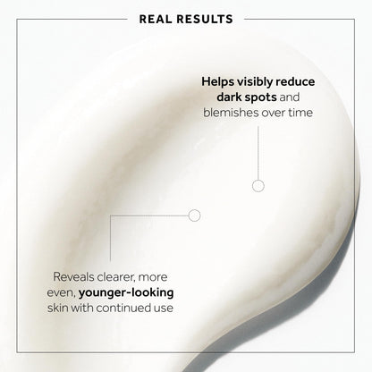 No7 Microdermabrasion Total Renewal Face Scrub - Exfoliating Face Wash & Dark Spot Corrector for Sensitive Skin
