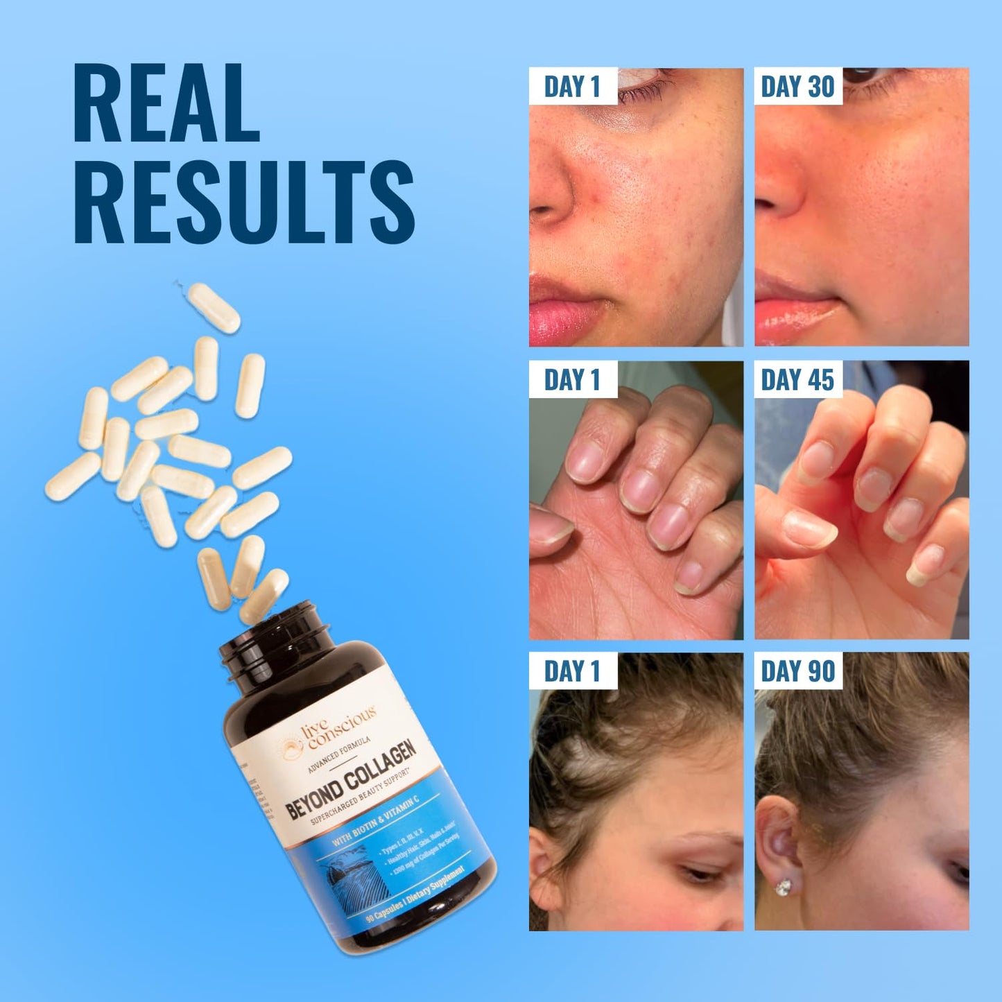 Live Conscious Beyond Collagen Multi Collagen Capsules - Types I, II, III, V & X - Hydrolyzed Blend with Biotin & Vitamin C