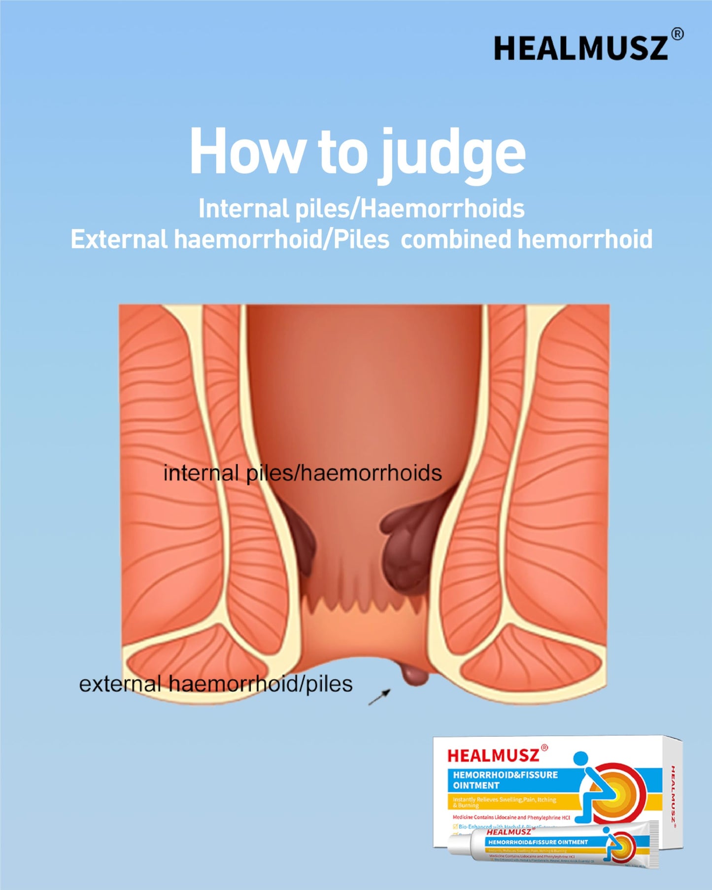 HEALMUSZ Hemorrhoid Fissure Ointment– Hemorrhoid Treatment and Hemorrhoid Cream with Lidocaine and Phenylephrine HCI for Fast Acting Relief of Pain, Swelling, Discomfort, and Itching(1.5 oz) HEALMUSZBuy Supplements Australia
