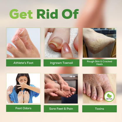 FOOT CURE Tea Tree Oil Foot Soak with Epsom Salt - Best Toenail Fungus Treatment, Athletes Foot & Softens Calluses - Soothes Sore & Tired Feet, Fungal Toe, Foot Odor Scent, Spa Pedicure (Pack of 2) FOOT CURE buy supplements Au