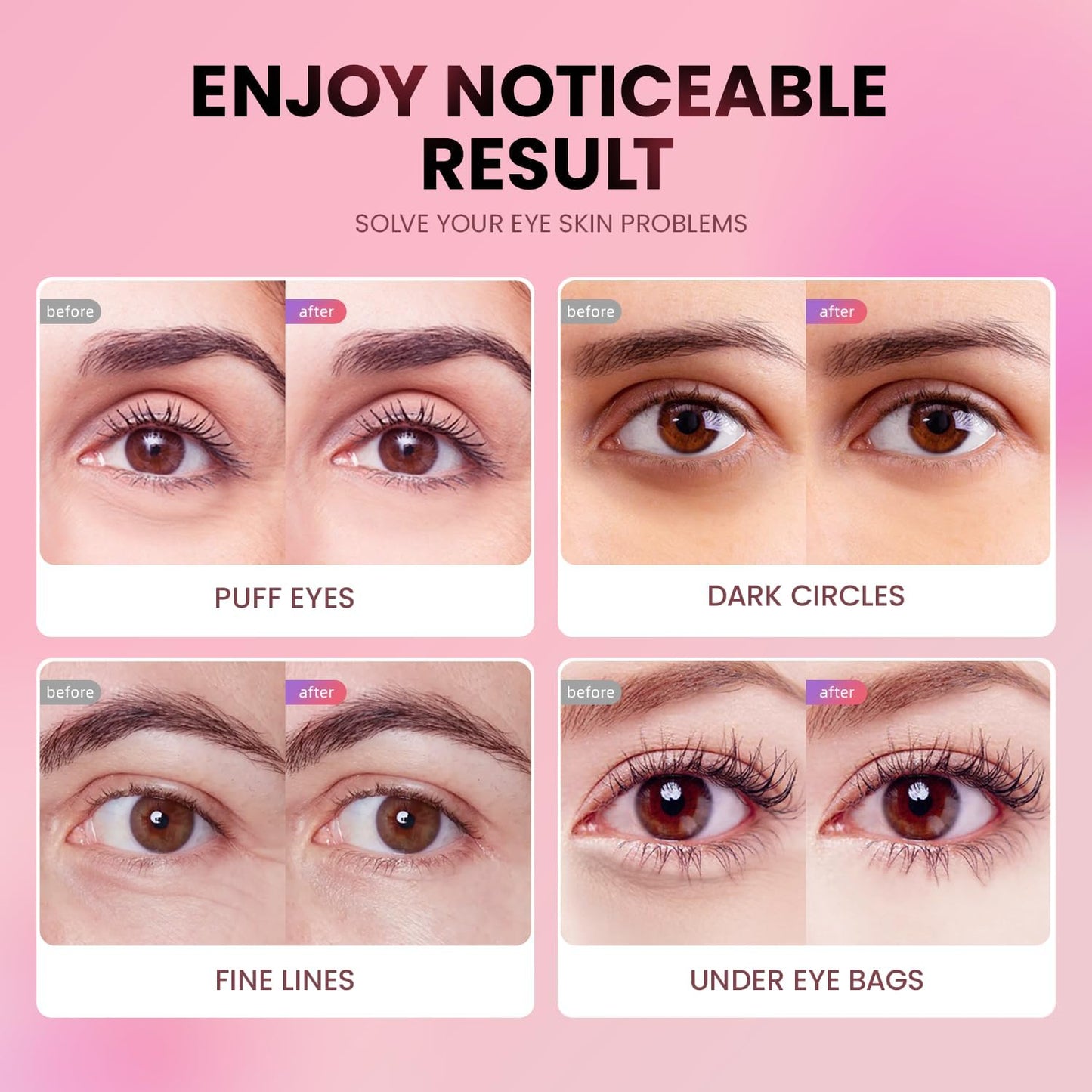 AILEORY Under Eye Patches (24 Pairs) - Tri-color Glitter Eye Gel Pads for Dark Circles, Puffy Eyes, Under eye Bags, Wrinkles