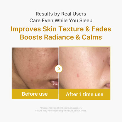 medicube Wrapping Mask Kojic Acid, Turmeric, Vitamin C Overnight Peel Off Facial Mask | Brighten & Defends Against Skin Stress for a Clear, Glowing Complexion | Korean Skin Care, 2.53 fl.oz