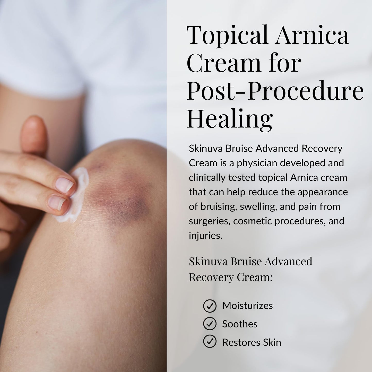 Skinuva® Bruise Advanced Recovery Cream - Topical Bruise Cream Formulated with Growth Factors, Arnica & Vitamin K (1 oz) SkinuvaBuy Supplements Australia