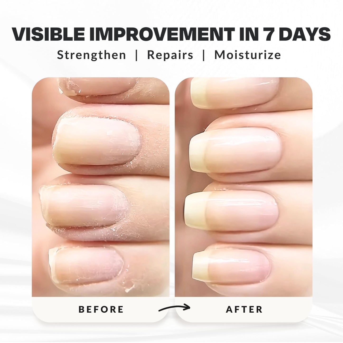 Nail Strengthener Power Boost Growth Formula, Keratin, Biotin, & Vitamin E, 21- Free, Repairs Damaged Nails, Stops Peeling & Chipping, Use as Clear Base Coat