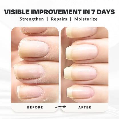 Nail Strengthener Power Boost Growth Formula, Keratin, Biotin, & Vitamin E, 21- Free, Repairs Damaged Nails, Stops Peeling & Chipping, Use as Clear Base Coat