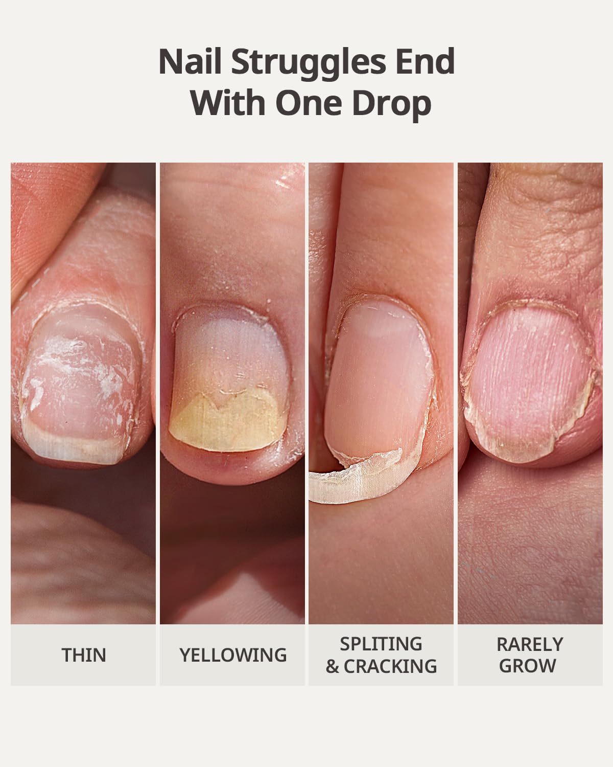 BTArtboxnails Naillush Nail Strengthener & Growth - Repair Damaged Nails, Strengthen Weak & Thin Nails, Extra Strong Nail Growth Treatment