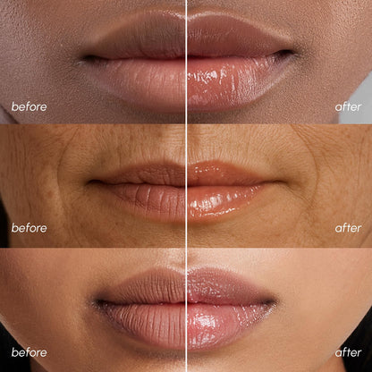 MAREE Lip Mask Overnight - Lip Moisturizer For Very Dry Lips - Hydrating Lip Butter Balm with Hyaluronic Acid & Collagen
