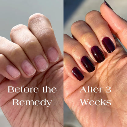 Botanist The Remedy | Nail Strengthening Polish | Repairs & Hardens Nails Damaged from Acrylics, Dip & Gel Manicures | Non-Toxic