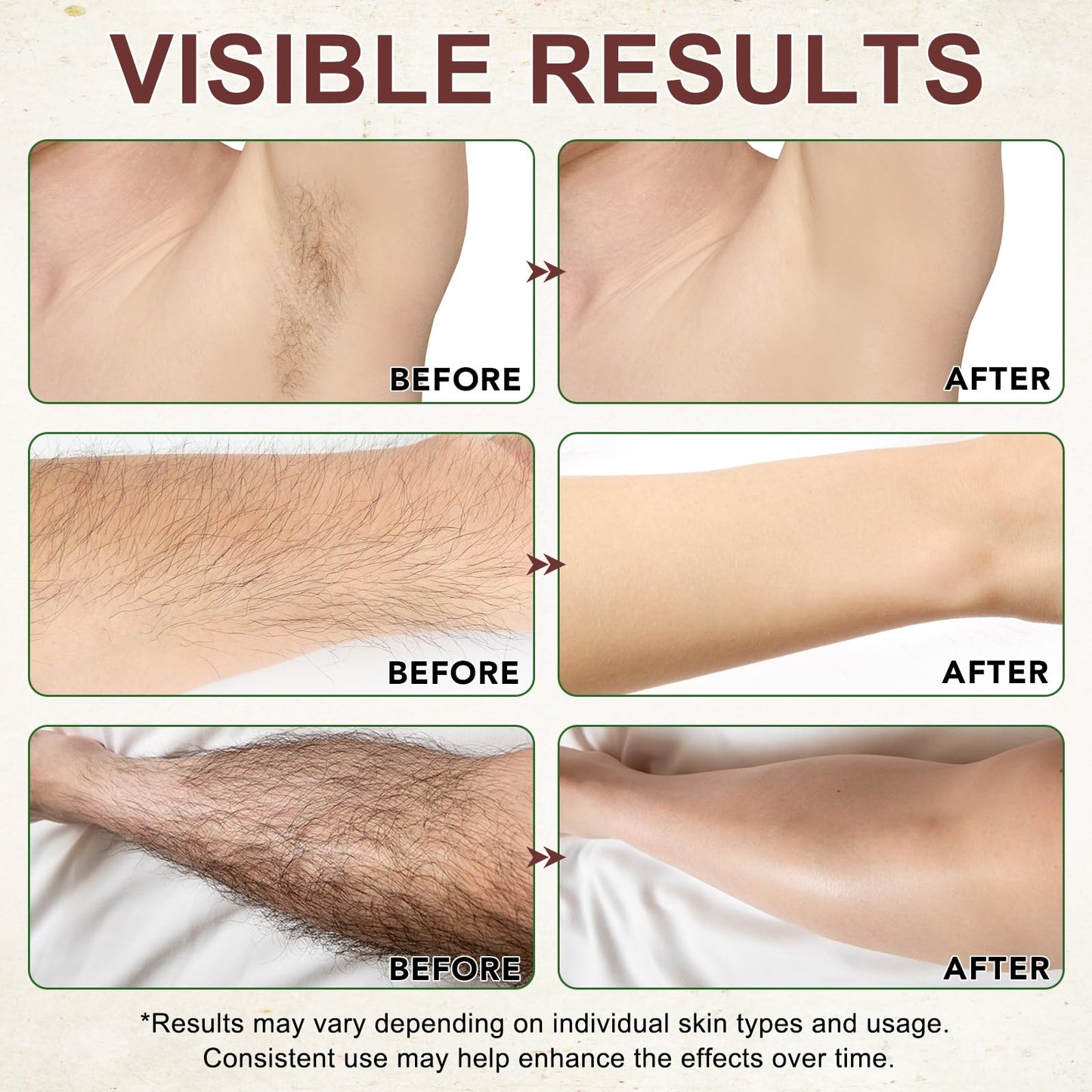 Cyperus Rotundus Oil, Natural for Reducing Body Hair Growth, Cyperus Rotundus Oil for Hair