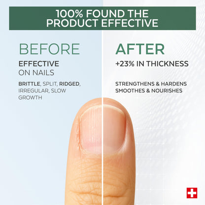 PODERM – 100% Natural Nail Repair - Revitalizes Damaged and Split Nails with Hydrating & Exfoliating Formula – Effective Nail care : Also Acts as a Nail Strengthener