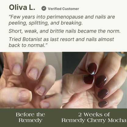 Botanist The Remedy | Nail Strengthening Polish | Repairs & Hardens Nails Damaged from Acrylics, Dip & Gel Manicures | Non-Toxic