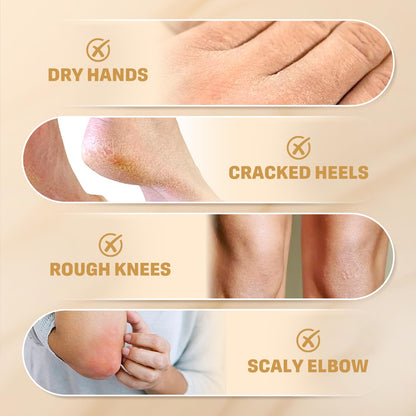 Clyecfra 60% Urea Cream with 2% Salicylic Acid, Urea Cream 60 Percent for Feet & Hands- Maximum Strength Moisturizer for Rough, Dry, Thick & Cracked Skin, Callus Remover, Deep Hydration, 150g