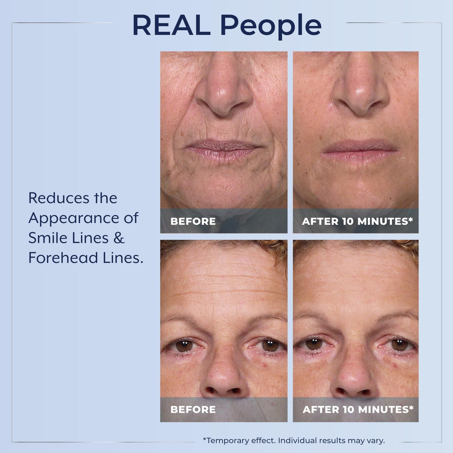 Plexaderm Rapid Reduction Eye Serum - Visibly Reduces Under-Eye Bags, Wrinkles, Dark Circles, Fine Lines & Crow's Feet Instantly
