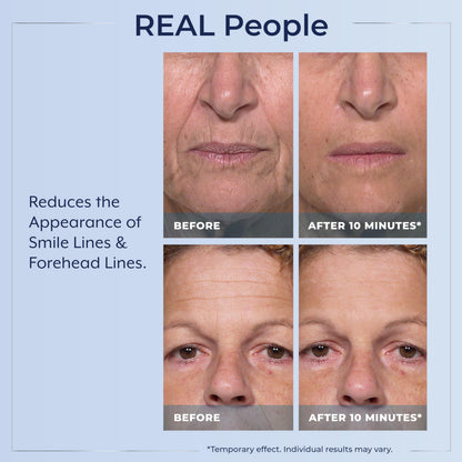 Plexaderm Rapid Reduction Eye Serum - Visibly Reduces Under-Eye Bags, Wrinkles, Dark Circles, Fine Lines & Crow's Feet Instantly