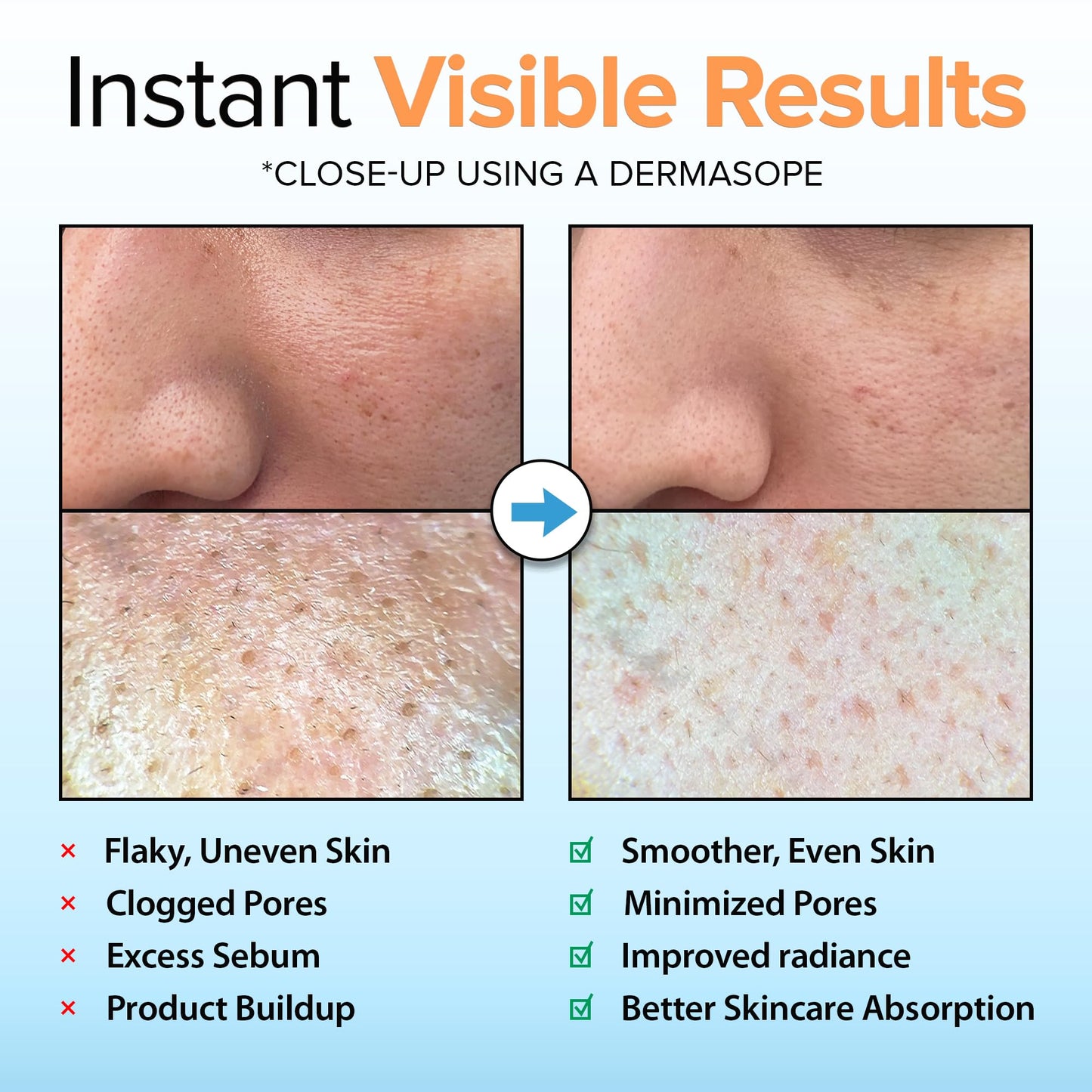 Ebanel Brightening Peeling Gel with Cotton Cellulose, Rice, Papaya, Centella, Hyaluronic Acid for Face and Body, Gentle Exfoliating Face Scrub Gel Peel Wash, Deep Pore Cleanser Minimizer Exfoliator