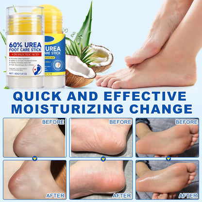 Loobexery 2 Pcs 60% Urea with 2% Salicylic Acid Foot Care Stick, Urea Foot Cream for Cracked Feet, Repairs Dry Rough Heels Fast, Foot Lotion Moisturizer for Dead Skin, Hydrating Heel Balm