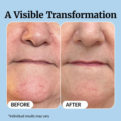 Vibriance Super C Serum for Mature Skin - All-in-One Vitamin Formula Hydrates, Firms,
