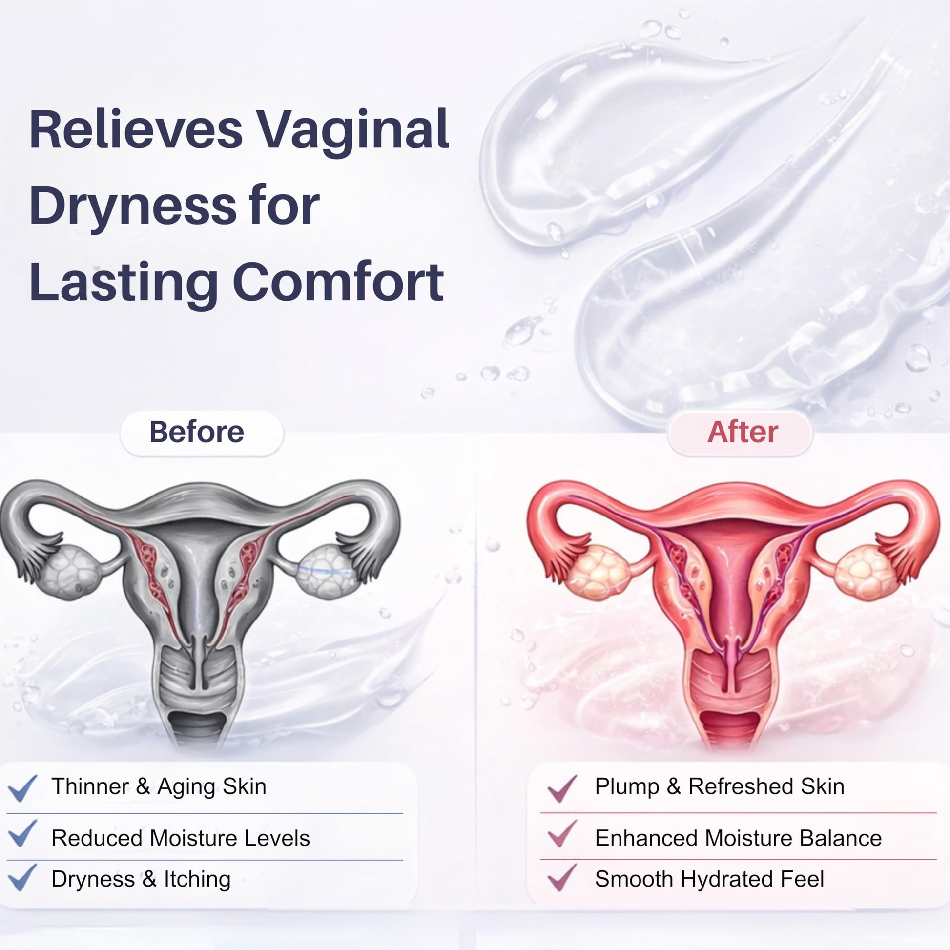 XORYTEN Vaginal Moisturizer for Revarey– 5mg Hyaluronic Acid – Vaginal Dryness, Hormone-Free Soothing Inserts, Non-Greasy, 12 Suppositories – 1 Month Supply (No fragrance) XORYTEN buy supplements Au