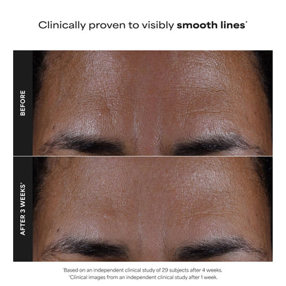 Paulas Choice--SKIN PERFECTING 2% BHA Liquid Salicylic Acid Exfoliant--Facial Exfoliant