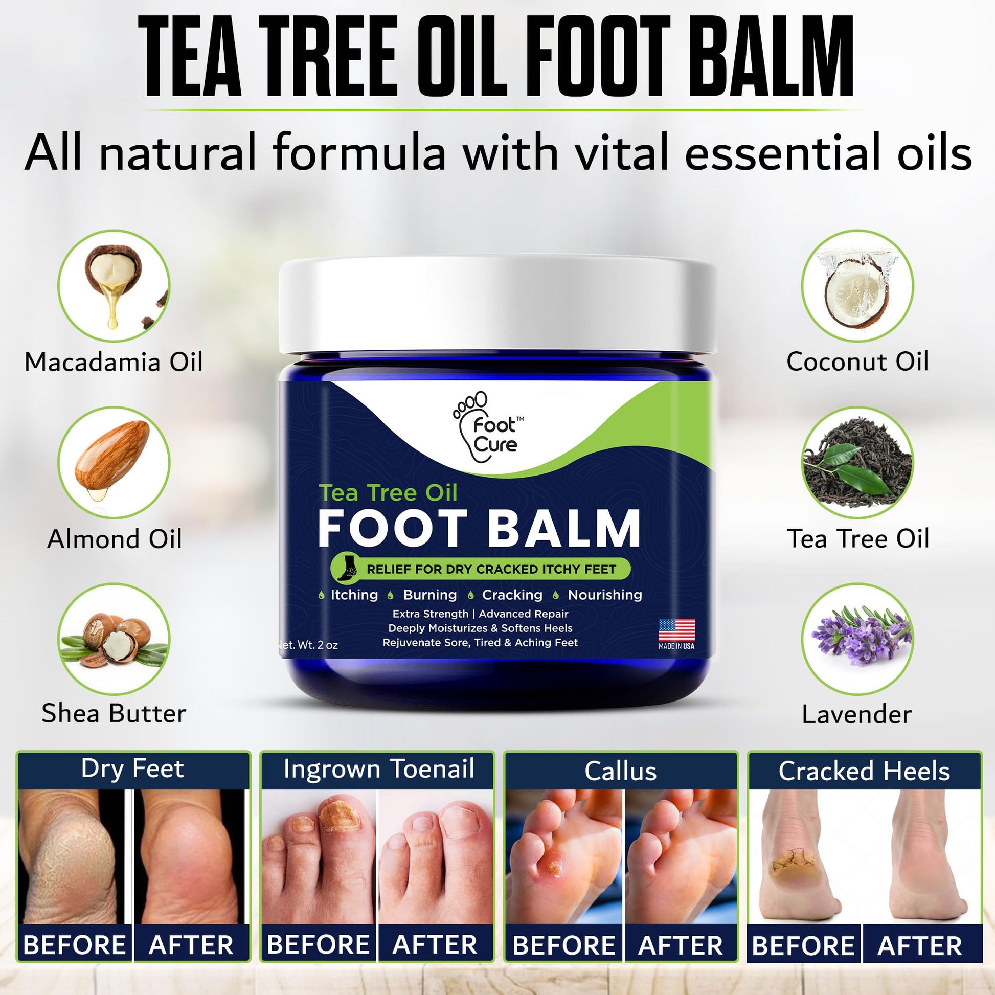 FOOT CURE Tea Tree Oil Balm – Moisturizer for Dry Cracked Feet – Instantly Hydrates & Soothes Irritated Skin & Athlete's Foot – Best Foot Care for Women and Men (Pack of 2) FOOT CURE buy supplements Au